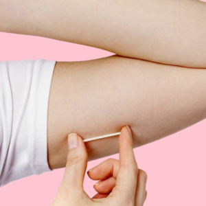 Nexplanon Implants